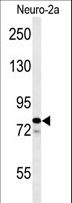 FAM91A1 Antibody - Western blot of F91A1 Antibody in Neuro-2a cell line lysates (35 ug/lane). F91A1 (arrow) was detected using the purified antibody.