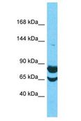 FAM91A1 Antibody - FAM91A1 antibody Western Blot of HepG2. Antibody dilution: 1 ug/ml.  This image was taken for the unconjugated form of this product. Other forms have not been tested.
