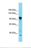 FAM91A1 Antibody - Western blot of Fetal Heart. FAM91A1 antibody dilution 1.0 ug/ml.  This image was taken for the unconjugated form of this product. Other forms have not been tested.