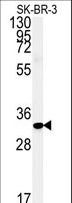 FAM92A1 Antibody - Western blot of FAM92A1 Antibody in SK-BR-3 cell line lysates (35 ug/lane). FAM92A1 (arrow) was detected using the purified antibody.