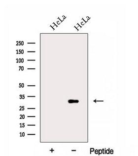 FAM92A1 Antibody - Western blot analysis of extracts of HeLa cells using FAM92A1 antibody. The lane on the left was treated with blocking peptide.
