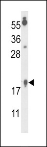 FAM96B Antibody - Western blot of FA96B Antibody in A375 cell line lysates (35 ug/lane). FA96B (arrow) was detected using the purified antibody.