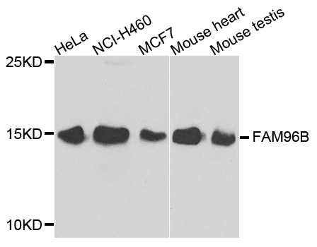 FAM96B Antibody - Western blot analysis of extracts of various cell lines.
