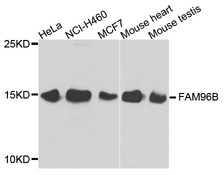 FAM96B Antibody - Western blot analysis of extracts of various cell lines.