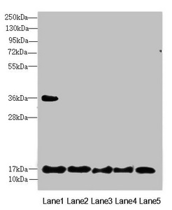 FAM96B Antibody - Western blot All Lanes:FAM96B antibody at 7.23 ug/ml Lane 1: Mouse gonadal tissue Lane 2: MCF7 whole cell lysate Lane 3: Hela whole cell lysate Lane 4: K562 whole cell lysate Lane 5: A375 whole cell lysate Secondary Goat polyclonal to rabbit IgG at 1/10000 dilution Predicted band size: 18 kDa Observed band size: 18,36 kDa