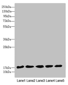 FAM96B Antibody - Western blot All Lanes:FAM96B antibody at 7.09 ug/ml Lane 1: Mouse gonadal tissue Lane 2: MCF7 whole cell lysate Lane 3: Hela whole cell lysate Lane 4: K562 whole cell lysate Lane 5: A375 whole cell lysate Secondary Goat polyclonal to rabbit IgG at 1/10000 dilution Predicted band size: 18 kDa Observed band size: 18 kDa