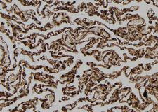 FAM96B Antibody - 1:100 staining human lung tissue by IHC-P. The sample was formaldehyde fixed and a heat mediated antigen retrieval step in citrate buffer was performed. The sample was then blocked and incubated with the antibody for 1.5 hours at 22°C. An HRP conjugated goat anti-rabbit antibody was used as the secondary.