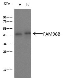 FAM98B Antibody - FAM98B was immunoprecipitated using: Lane A: 0.5 mg Caco2 Whole Cell Lysate. Lane B: 0.5 mg Jurkat Whole Cell Lysate. 2 uL anti-FAM98B rabbit polyclonal antibody and 60 ug of Immunomagnetic beads Protein A/G. Primary antibody: Anti-FAM98B rabbit polyclonal antibody, at 1:100 dilution. Secondary antibody: Clean-Blot IP Detection Reagent (HRP) at 1:1000 dilution. Developed using the ECL technique. Performed under reducing conditions. Predicted band size: 37 kDa. Observed band size: 45 kDa.