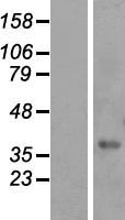 FAM98C Protein - Western validation with an anti-DDK antibody * L: Control HEK293 lysate R: Over-expression lysate