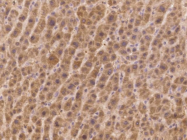 FAM9B Antibody - Immunochemical staining of human FAM9B in human liver with rabbit polyclonal antibody at 1:300 dilution, formalin-fixed paraffin embedded sections.