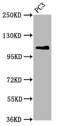 FAN1 Antibody - Western Blot Positive WB detected in: PC3 whole cell lysate All Lanes: FAN1 antibody at 5.3µg/ml Secondary Goat polyclonal to rabbit IgG at 1/50000 dilution Predicted band size: 115, 60 KDa Observed band size: 115 KDa