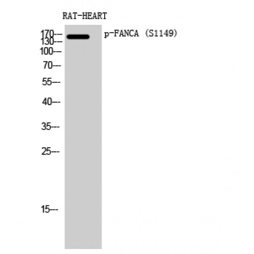 FANCA Antibody - Western blot of Phospho-FANCA (S1149) antibody