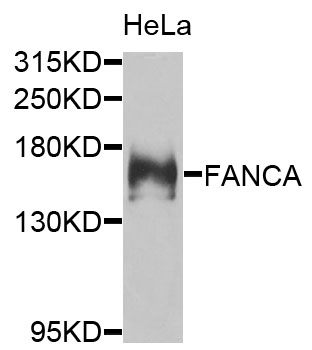 FANCA Antibody - Western blot analysis of extracts of HeLa cells.