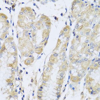 FANCA Antibody - Immunohistochemistry of paraffin-embedded human stomach tissue.