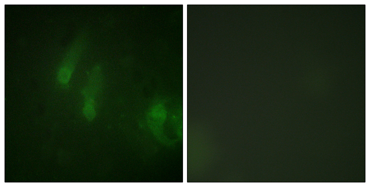 FANCA Antibody - Immunofluorescence analysis of HeLa cells, using FANCA (Phospho-Ser1149) Antibody. The picture on the right is blocked with the phospho peptide.