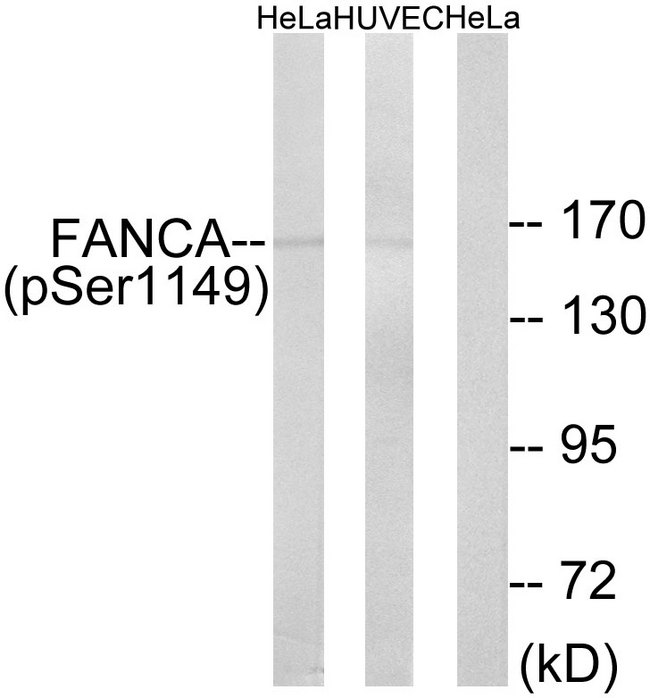 FANCA Antibody - Western blot analysis of lysates from HeLa cells treated with IGF 100ng/ml 10' and HUVEC cells treated with EGF 200ng/ml 30', using FANCA (Phospho-Ser1149) Antibody. The lane on the right is blocked with the phospho peptide.
