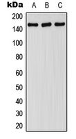 FANCA Antibody - Western blot analysis of FANCA (pS1149) expression in HepG2 EGF-treated (A); SP2/0 EGF-treated (B); H9C2 EGF-treated (C) whole cell lysates.