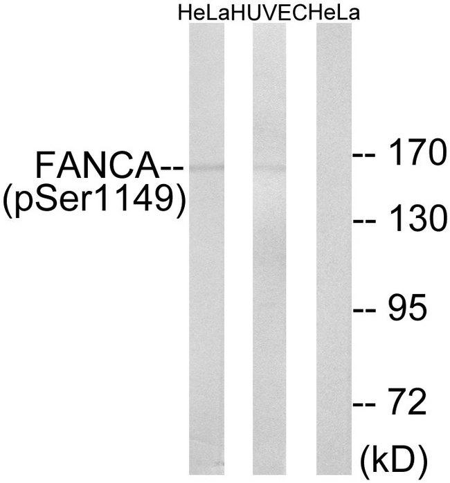 FANCA Antibody - Western blot analysis of extracts from HELA cells treated with IGF (100ng/ml, 10mins) and HUVEC cells treated with EGF (200ng/ml, 30mins), using FANCA (Phospho-Ser1149) antibody.