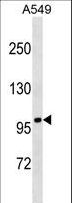 FANCB / FAB Antibody - FANCB Antibody western blot of A549 cell line lysates (35 ug/lane). The FANCB antibody detected the FANCB protein (arrow).