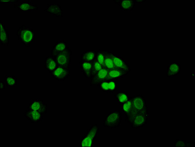 FANCB / FAB Antibody - Immunofluorescence staining of PC3 cells diluted at 1:100, counter-stained with DAPI. The cells were fixed in 4% formaldehyde, permeabilized using 0.2% Triton X-100 and blocked in 10% normal Goat Serum. The cells were then incubated with the antibody overnight at 4°C.The Secondary antibody was Alexa Fluor 488-congugated AffiniPure Goat Anti-Rabbit IgG (H+L).