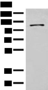 FANCB / FAB Antibody - Western blot analysis of Hela cell lysate  using FANCB Polyclonal Antibody at dilution of 1:550