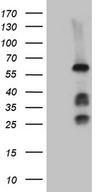 FANCC Antibody - HEK293T cells were transfected with the pCMV6-ENTRY control. (Left lane) or pCMV6-ENTRY FANCC. (Right lane) cDNA for 48 hrs and lysed. Equivalent amounts of cell lysates. (5 ug per lane) were separated by SDS-PAGE and immunoblotted with anti-FANCC. (1:2000)