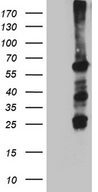 FANCC Antibody - HEK293T cells were transfected with the pCMV6-ENTRY control. (Left lane) or pCMV6-ENTRY FANCC. (Right lane) cDNA for 48 hrs and lysed. Equivalent amounts of cell lysates. (5 ug per lane) were separated by SDS-PAGE and immunoblotted with anti-FANCC. (1:2000)