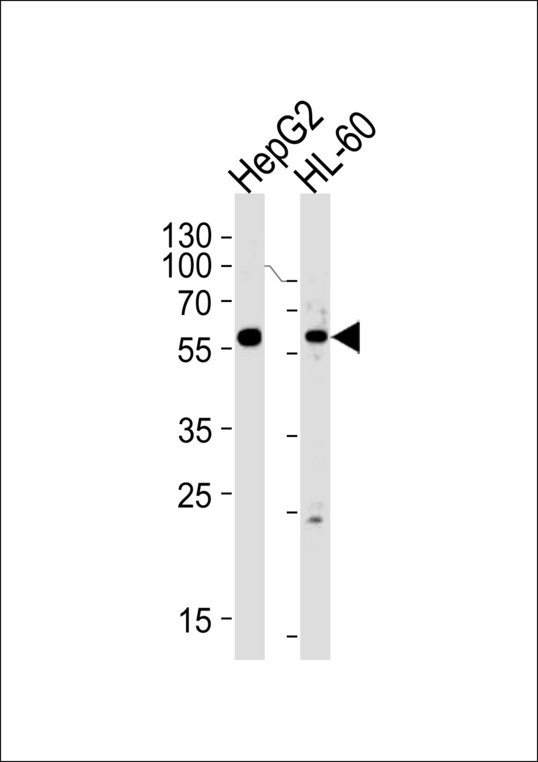 FANCC Antibody - Western blot of lysates from HepG2,HL-60 cell line (from left to right),using FANCC Antibody. Antibody was diluted at 1:1000 at each lane. A goat anti-rabbit IgG H&L (HRP) at 1:5000 dilution was used as the secondary antibody.Lysates at 35ug per lane.