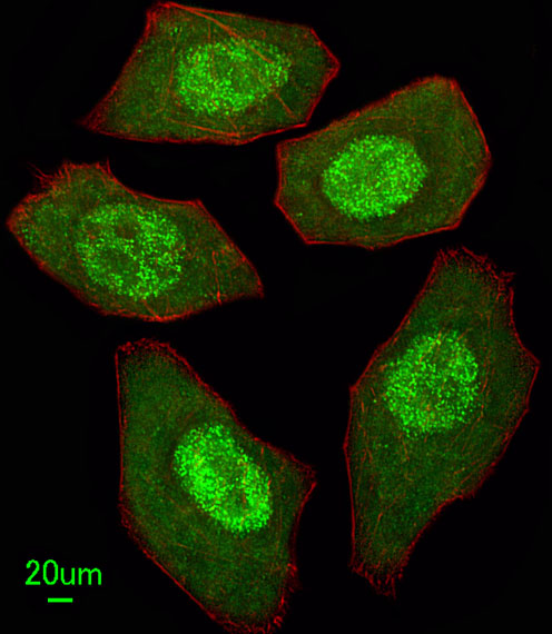 FANCC Antibody - Immunofluorescence of U251 cells, using FANCC Antibody. Antibody was diluted at 1:25 dilution. Alexa Fluor 488-conjugated goat anti-rabbit lgG at 1:400 dilution was used as the secondary antibody (green). DAPI was used to stain the cell nuclear (blue).