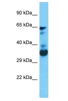 FANCC Antibody - FANCC antibody Western Blot of COLO205. Antibody dilution: 1 ug/ml.  This image was taken for the unconjugated form of this product. Other forms have not been tested.