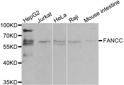 FANCC Antibody - Western blot analysis of extracts of various cell lines, using FANCC antibody at 1:1000 dilution. The secondary antibody used was an HRP Goat Anti-Rabbit IgG (H+L) at 1:10000 dilution. Lysates were loaded 25ug per lane and 3% nonfat dry milk in TBST was used for blocking.