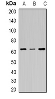FANCC Antibody - Western blot analysis of FANCC expression in Jurkat (A); HeLa (B); mouse intestine (C) whole cell lysates.
