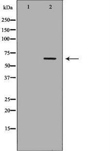 FANCC Antibody - Western blot analysis of HeLa whole cells lysates using FANCC antibody. The lane on the left is treated with the antigen-specific peptide.
