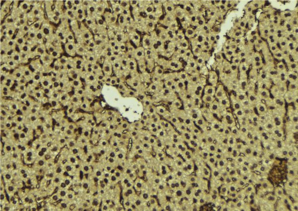 FANCC Antibody - 1:100 staining mouse liver tissue by IHC-P. The sample was formaldehyde fixed and a heat mediated antigen retrieval step in citrate buffer was performed. The sample was then blocked and incubated with the antibody for 1.5 hours at 22°C. An HRP conjugated goat anti-rabbit antibody was used as the secondary.