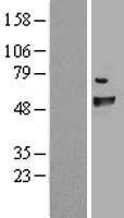 FANCC Protein - Western validation with an anti-DDK antibody * L: Control HEK293 lysate R: Over-expression lysate