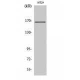 FANCD2 Antibody - Western blot of FANCD2 antibody