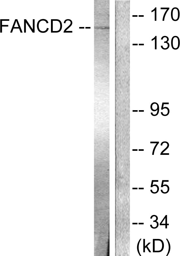 FANCD2 Antibody - Western blot analysis of lysates from HT-29 cells, treated with Calyculin A 50ng/ml 30', using FANCD2 Antibody. The lane on the right is blocked with the synthesized peptide.