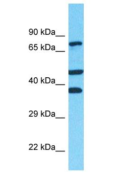 FANCD2 Antibody - FANCD2 antibody Western Blot of NCI-H226. Antibody dilution: 1 ug/ml.  This image was taken for the unconjugated form of this product. Other forms have not been tested.