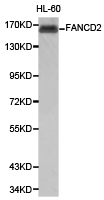 FANCD2 Antibody - Western blot of extracts of HL-60 cell lines, using FANCD2 antibody.