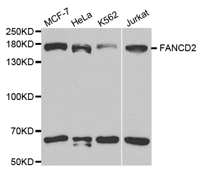 FANCD2 Antibody - Western blot analysis of extracts of various cell lines.