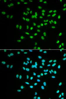 FANCD2 Antibody - Immunofluorescence analysis of MCF7 cells.