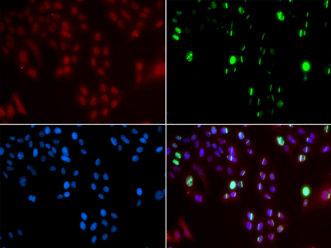 FANCD2 Antibody - Immunofluorescence analysis of GFP-RNF168 transgenic U2OS cells.