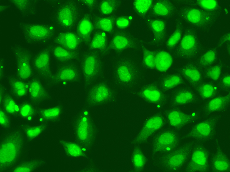 FANCD2 Antibody - Immunofluorescence analysis of A549 cells.