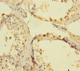 FANCD2 Antibody - Immunohistochemistry of paraffin-embedded human testis tissue using FANCD2 Antibody at dilution of 1:100