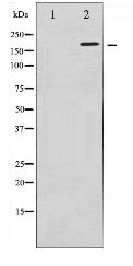 FANCD2 Antibody - Western blot of FANCD2 expression in Calyculin A treated HT29 whole cell lysates,The lane on the left is treated with the antigen-specific peptide.
