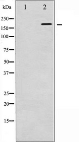 FANCD2 Antibody - Western blot analysis of FANCD2 expression in CalyculinA treated HT29 whole cells lysates. The lane on the left is treated with the antigen-specific peptide.