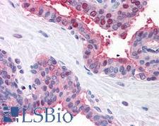 FANCD2 Antibody - Human Prostate (formalin-fixed, paraffin-embedded) stained with FANCD2 antibody LS-B493 at 2.5-5 ug/ml followed by biotinylated goat anti-rabbit IgG secondary antibody, alkaline phosphatase-streptavidin and chromogen.  This image was taken for the unconjugated form of this product. Other forms have not been tested.