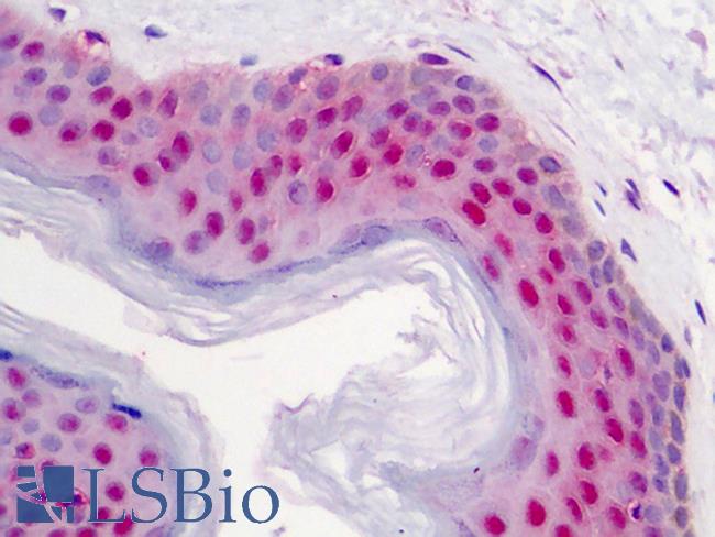 FANCD2 Antibody - Anti-FANCD2 antibody IHC of human skin. Immunohistochemistry of formalin-fixed, paraffin-embedded tissue after heat-induced antigen retrieval. Antibody concentration 2.5 ug/ml. This image was taken for the unconjugated form of this product. Other forms have not been tested.