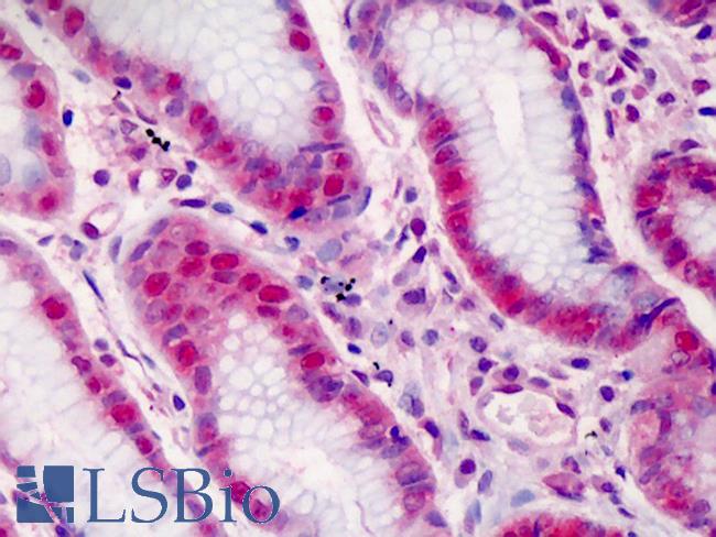 FANCD2 Antibody - Anti-FANCD2 antibody IHC of human stomach. Immunohistochemistry of formalin-fixed, paraffin-embedded tissue after heat-induced antigen retrieval. Antibody concentration 2.5 ug/ml. This image was taken for the unconjugated form of this product. Other forms have not been tested.