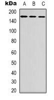 FANCD2 Antibody - Western blot analysis of FANCD2 expression in HT29 (A); SP20 (B); mouse liver (C) whole cell lysates.